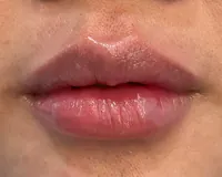 Sesudah