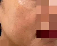 Sesudah